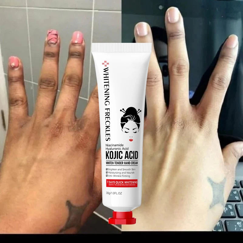 Kojic Acid Hand & Body Cream – Brightening & Moisturizing
