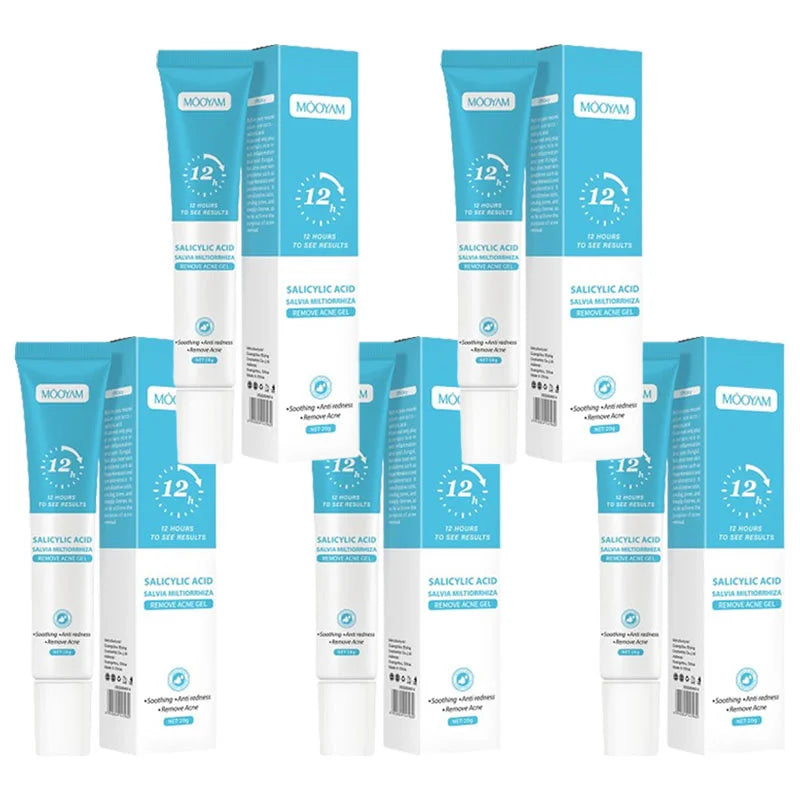 Acne Face Cream – Pimple Treatment & Oil Control Care
