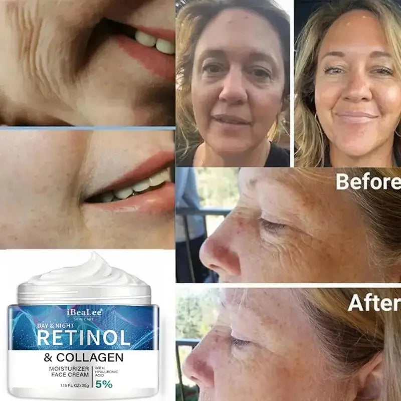 Retinol Anti-Wrinkle Cream – Men’s Collagen Face & Neck Care