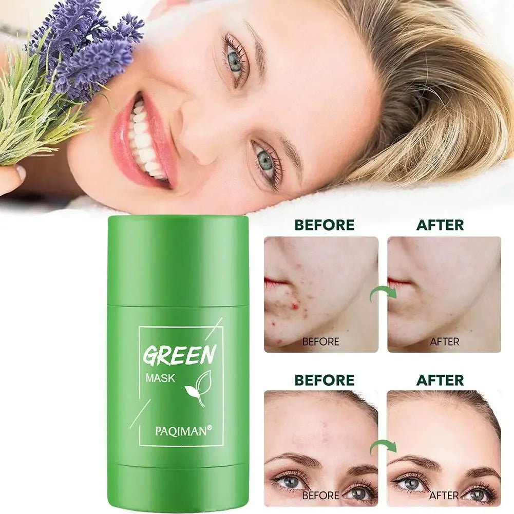Green Tea Cleansing Mask Stick – Acne & Blackhead Care