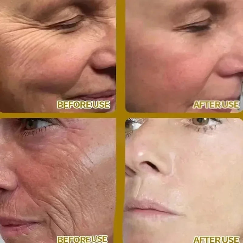 Wrinkle Remover Face Serum – Anti-Aging & Skin Firming