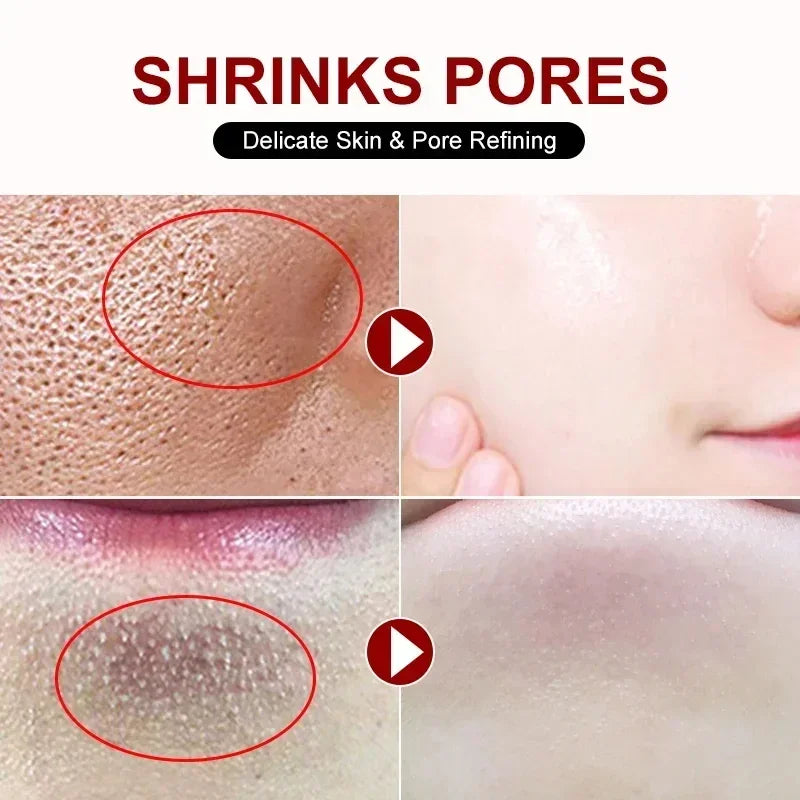 Salicylic Acid Pore Cream – Blackhead & Skin Repair Care