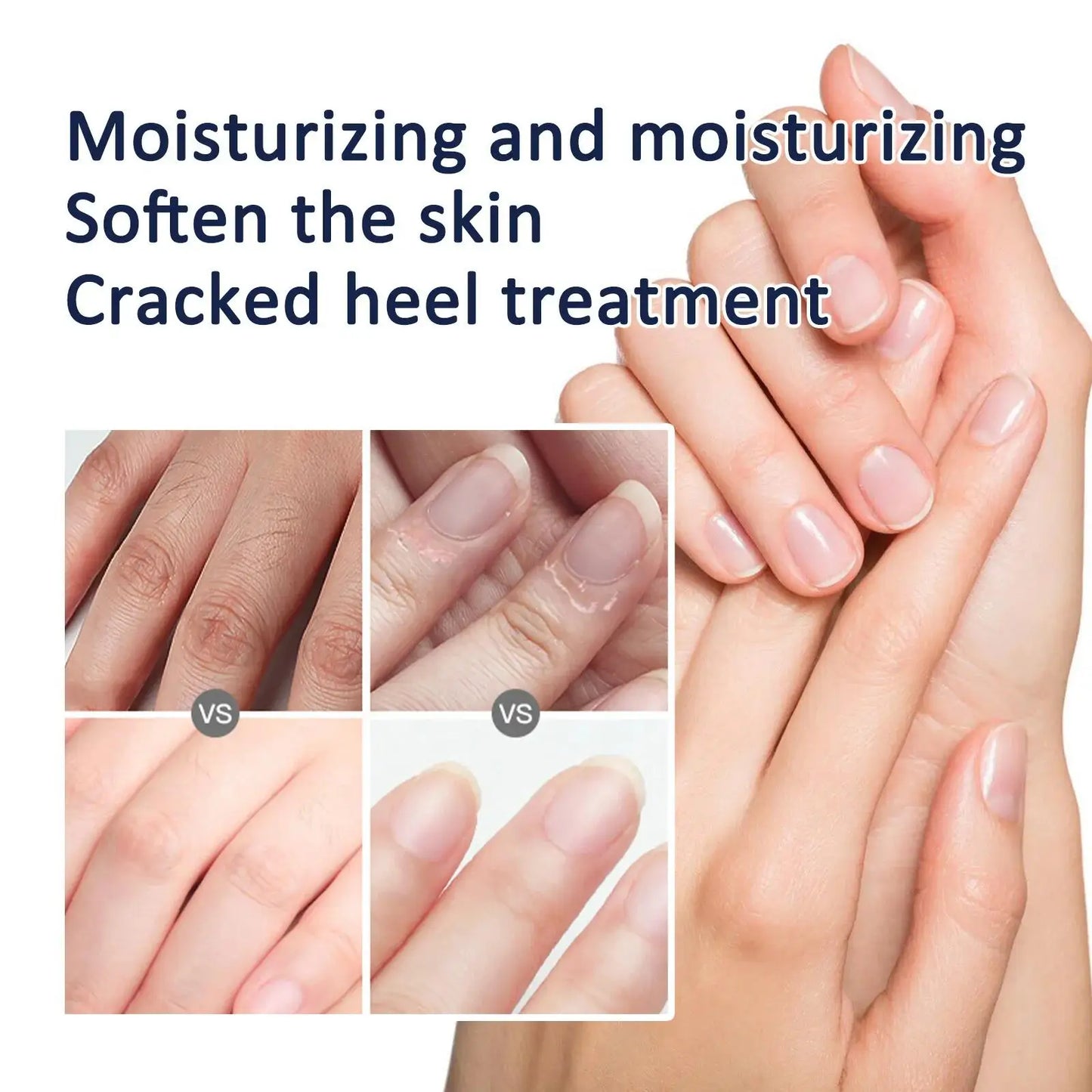 Whitening Hand Cream – Anti-Wrinkle & Repair Lotion