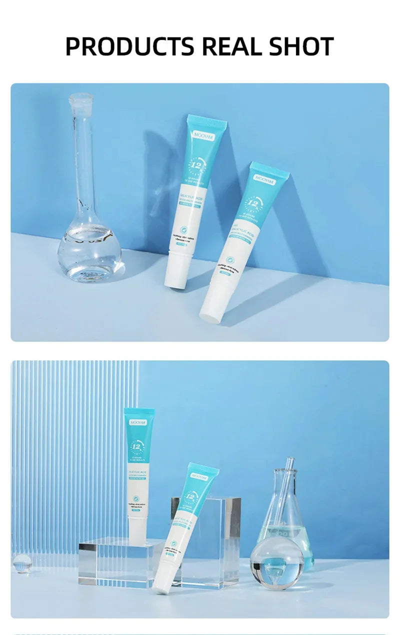 Acne Face Cream – Pimple Treatment & Oil Control Care