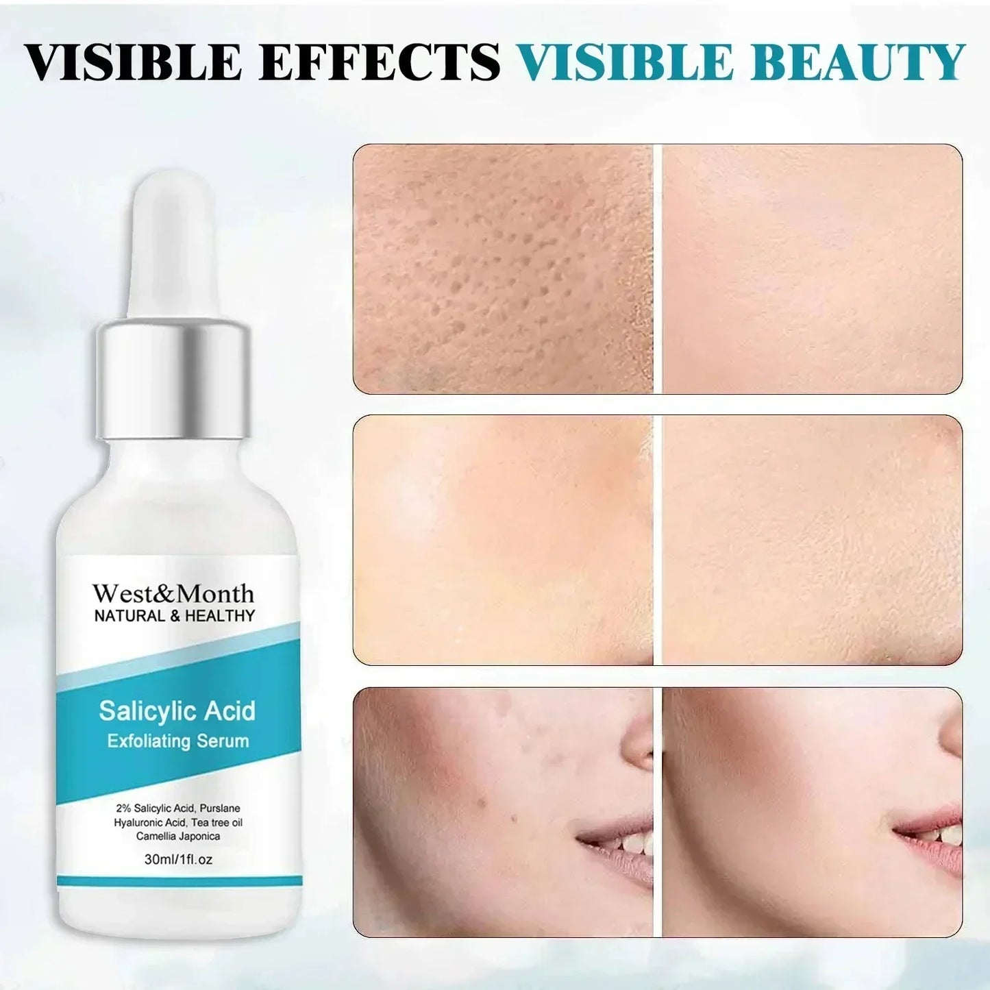 Facial Skin Peel Serum – Chemical Peel for Acne & Wrinkles