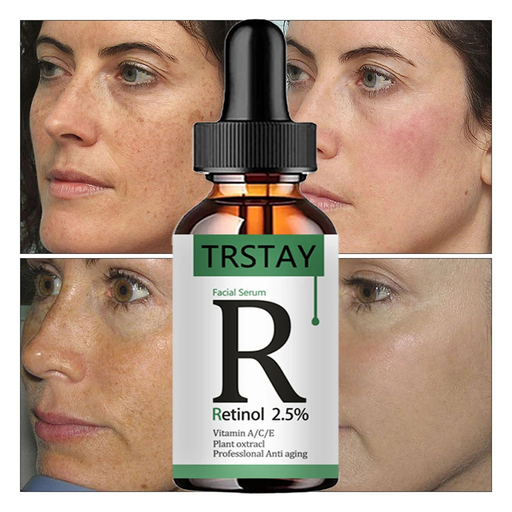 Retinol 2.5% & Vitamin C Serum – Anti-Aging & Whitening Essence