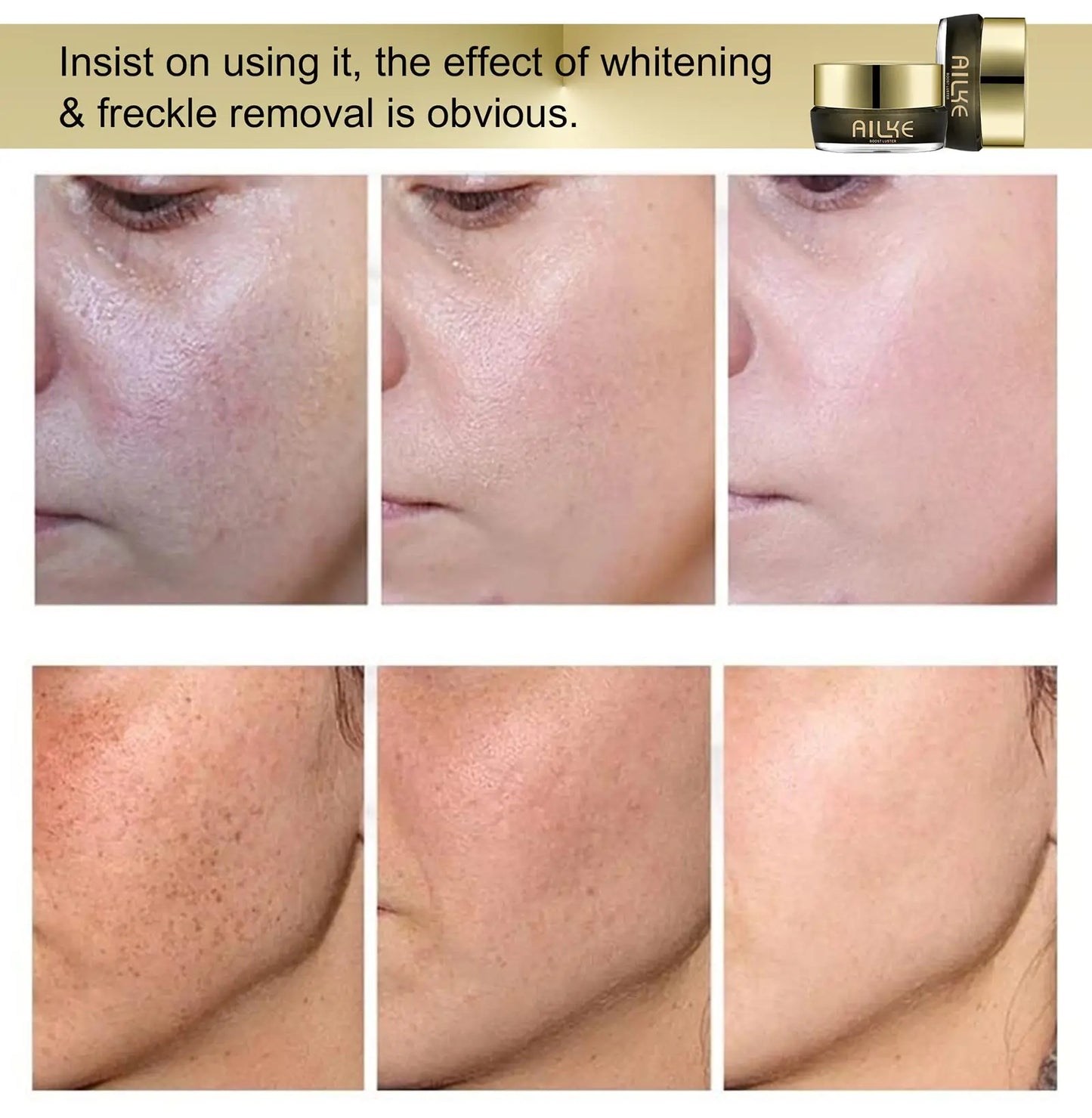 AILKE Lightening Face Cream – Dark Spot & Melanin Care