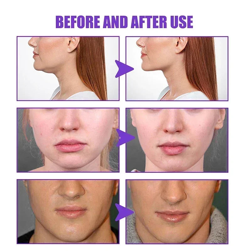 Double Chin Remover – Face Slimming Tool