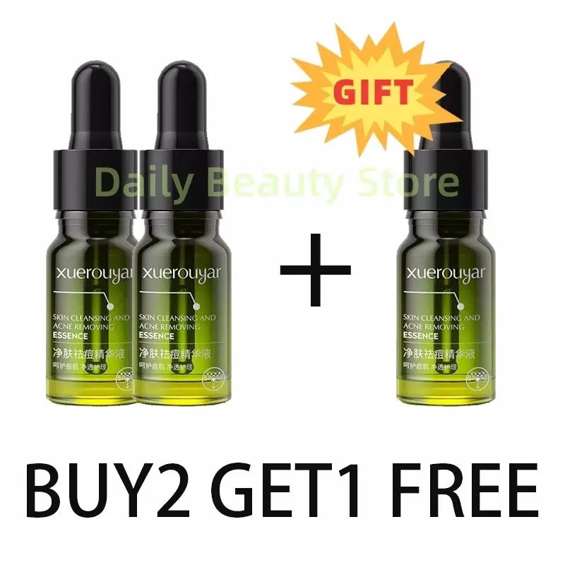 Salicylic Acid Acne Serum – Pore & Oil Control Treatment