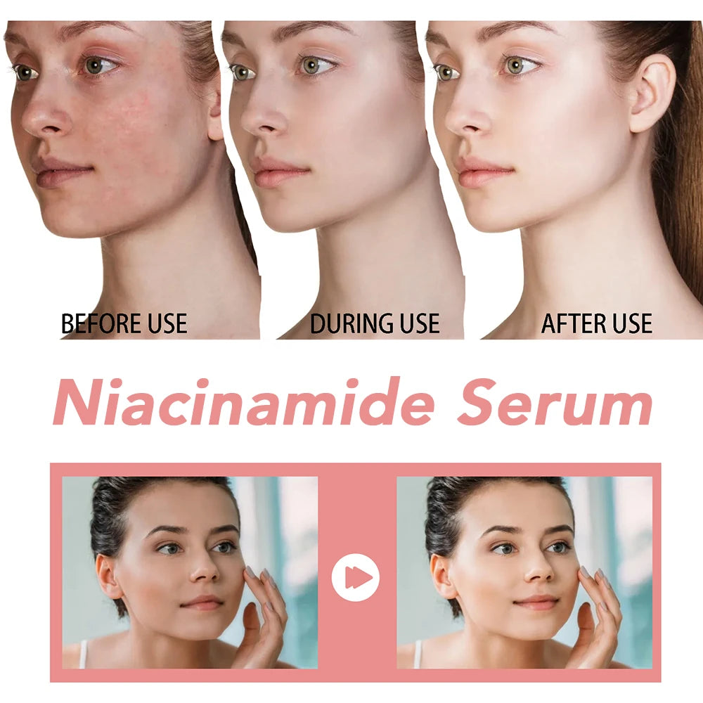 Niacinamide Facial Serum Hyaluronic Acid Vitamin B12 deep hydration Pore Minimizer for Face Brightening Glowing Skin Essenece