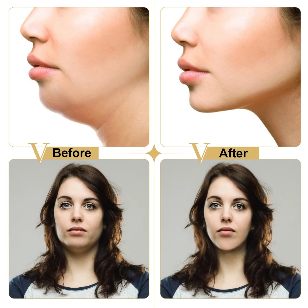 Reusable Face Lift Mask – V-Shape Slimming Patch