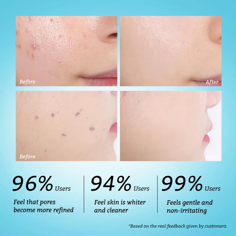 RtopR Exfoliating Facial Gel – Pore Cleanser & Scrub