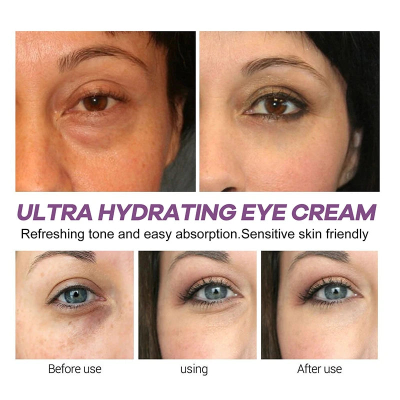 Instant Eye Bag Removal Cream – Retinol Firming Care