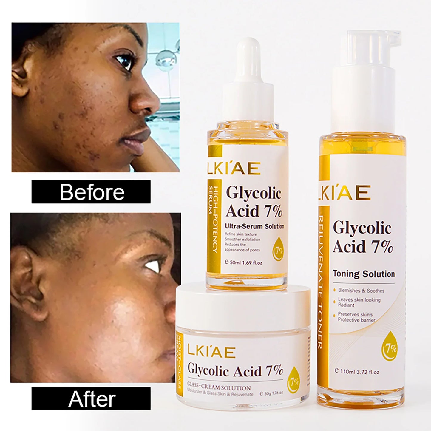 LKIAE Day & Night Face Cream – Brightening & Moisturizing