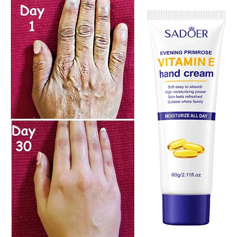 Whitening Hand Cream – Anti-Wrinkle & Repair Lotion