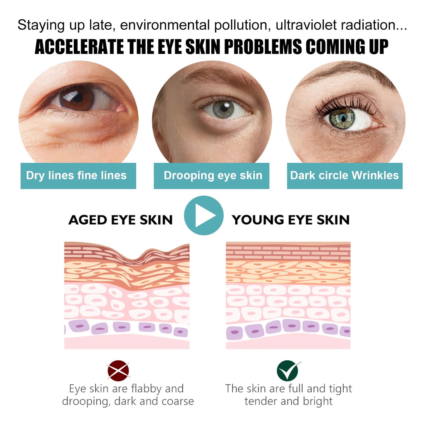 Anti-Wrinkle Eye Cream – Moisturizing & Firming Care
