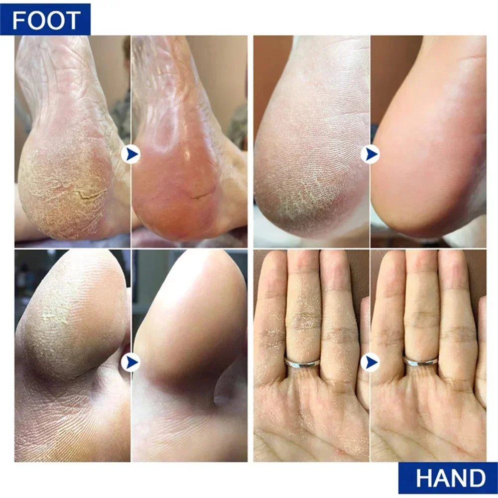 Collagen Hand Cream – Soften & Repair Dry Skin