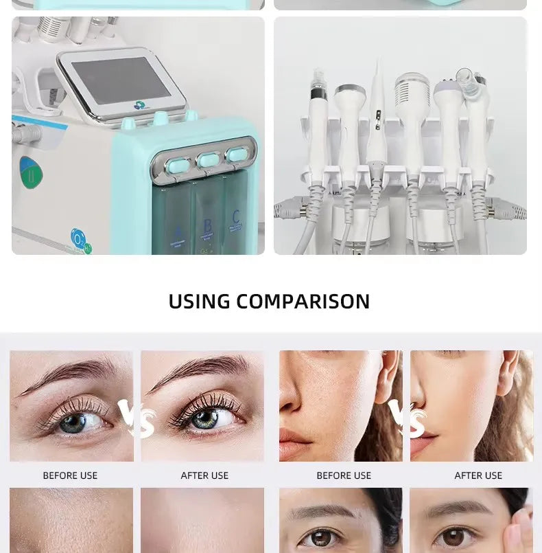 7-in-1 Hydra Facial Machine – Professional Skin Care Device