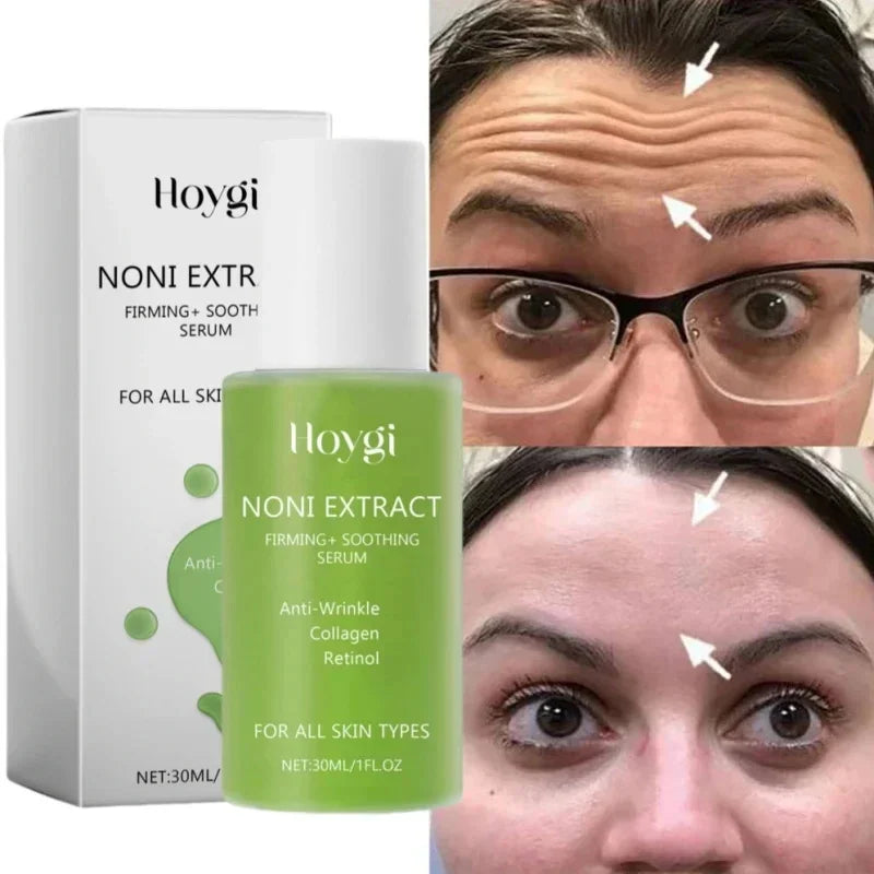 Noni Fruit Face Serum – Anti-Wrinkle & Moisturizing Essence