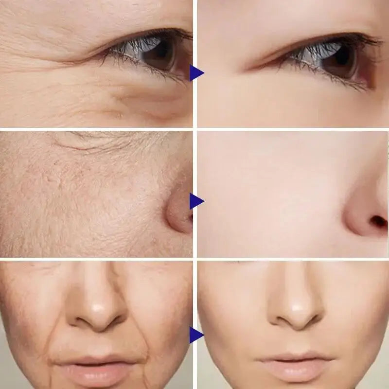 Retinol & Collagen Face Cream – Anti-Aging Wrinkle Remover
