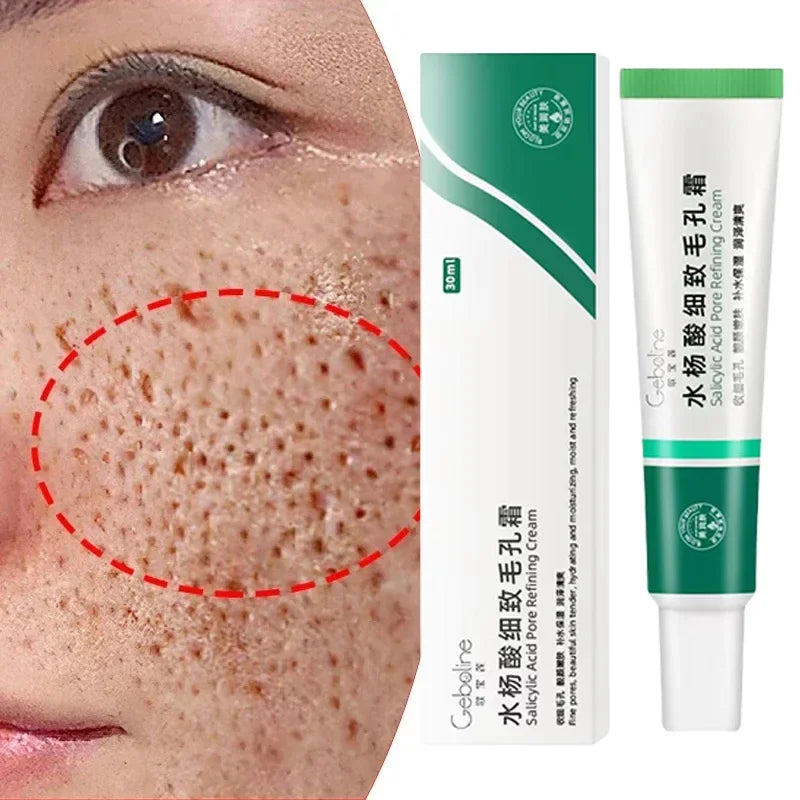 Salicylic Acid Pore Cream – Blackhead & Skin Repair Care