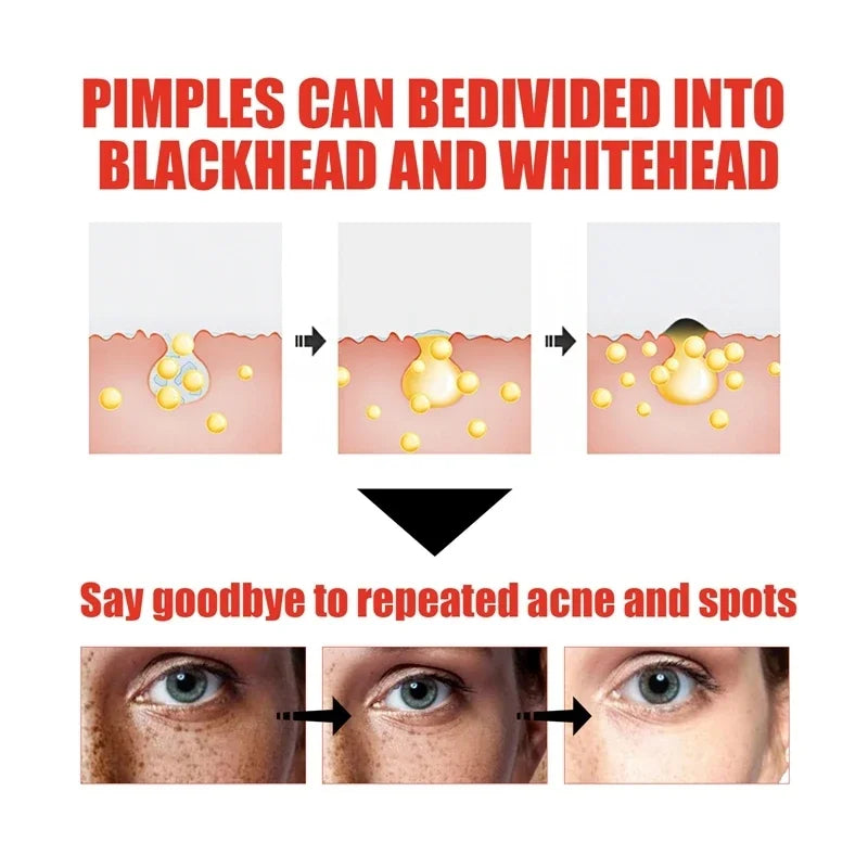 Niacinamide & Salicylic Acid Serum – Sensitive Skin Repair