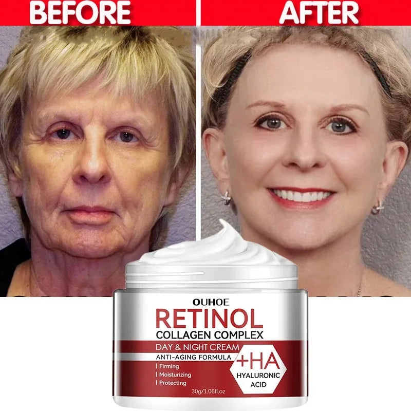 Retinol Face Cream – Korean Anti-Aging Skincare