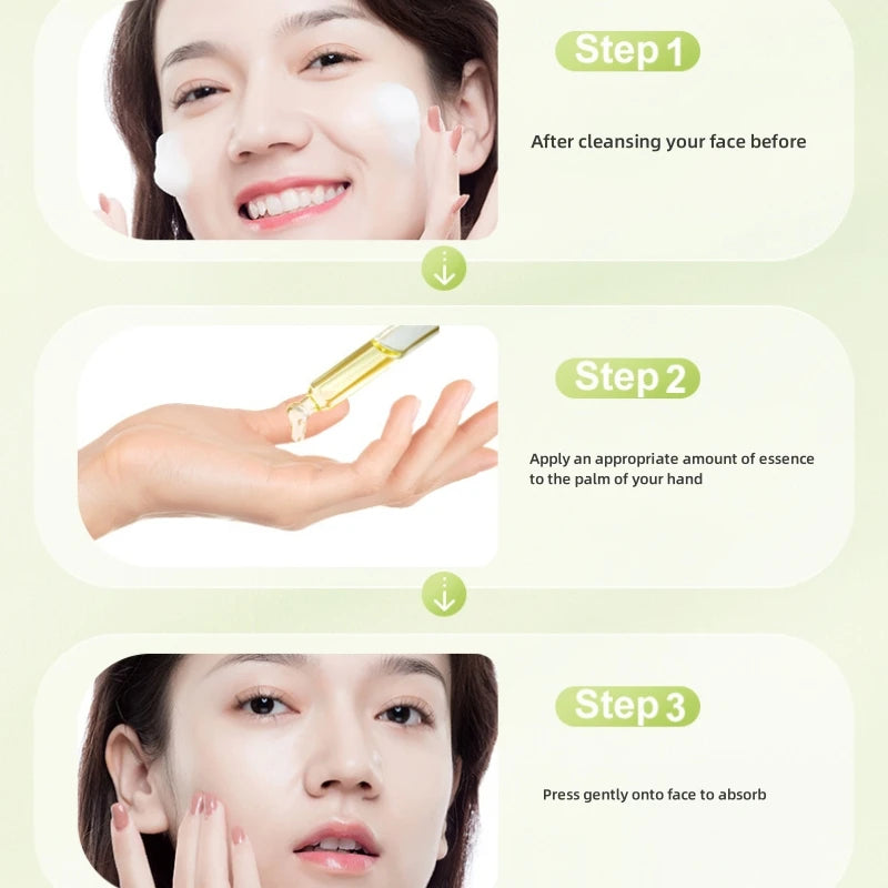 Salicylic Acid Acne Serum – Pore & Oil Control Treatment