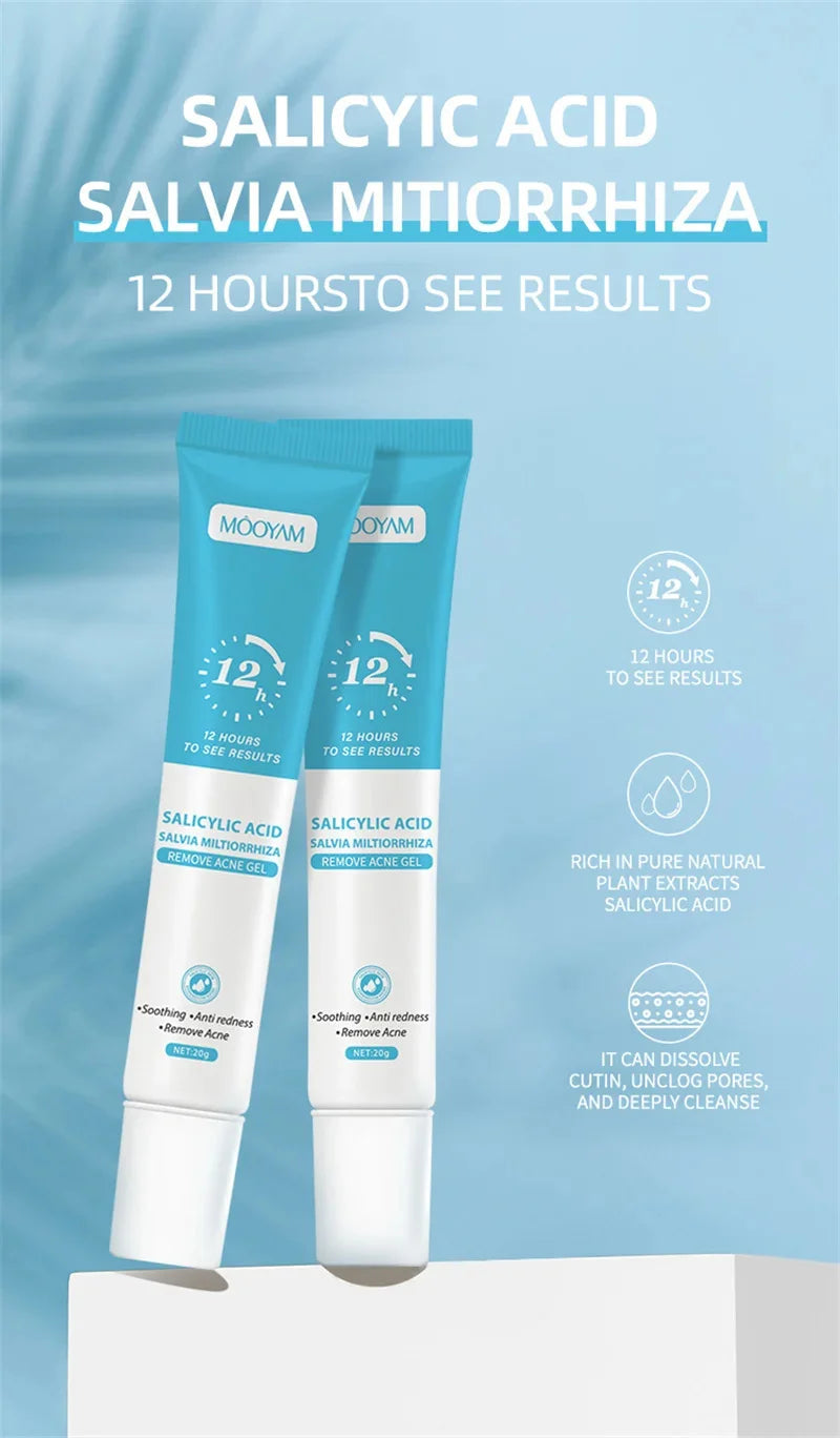 Acne Face Cream – Pimple Treatment & Oil Control Care