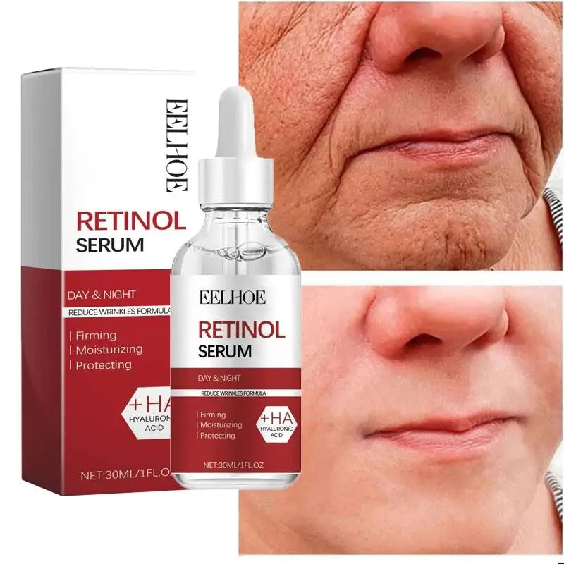 Retinol & Collagen Face Cream – Anti-Aging Wrinkle Remover