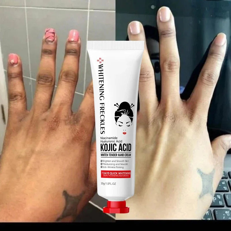 Kojic Acid Hand Cream – Brightening & Nourishing Skin Care