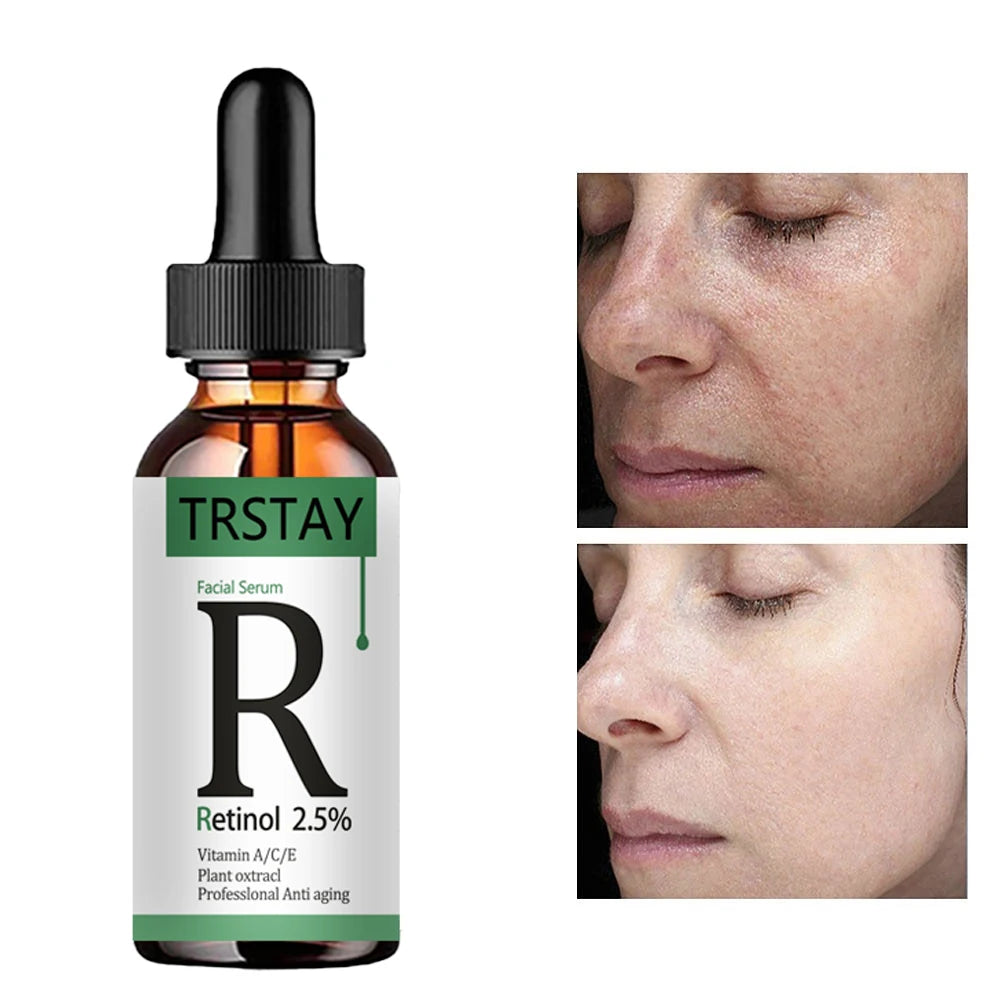 Retinol 2.5% & Vitamin C Serum – Anti-Aging & Whitening Essence