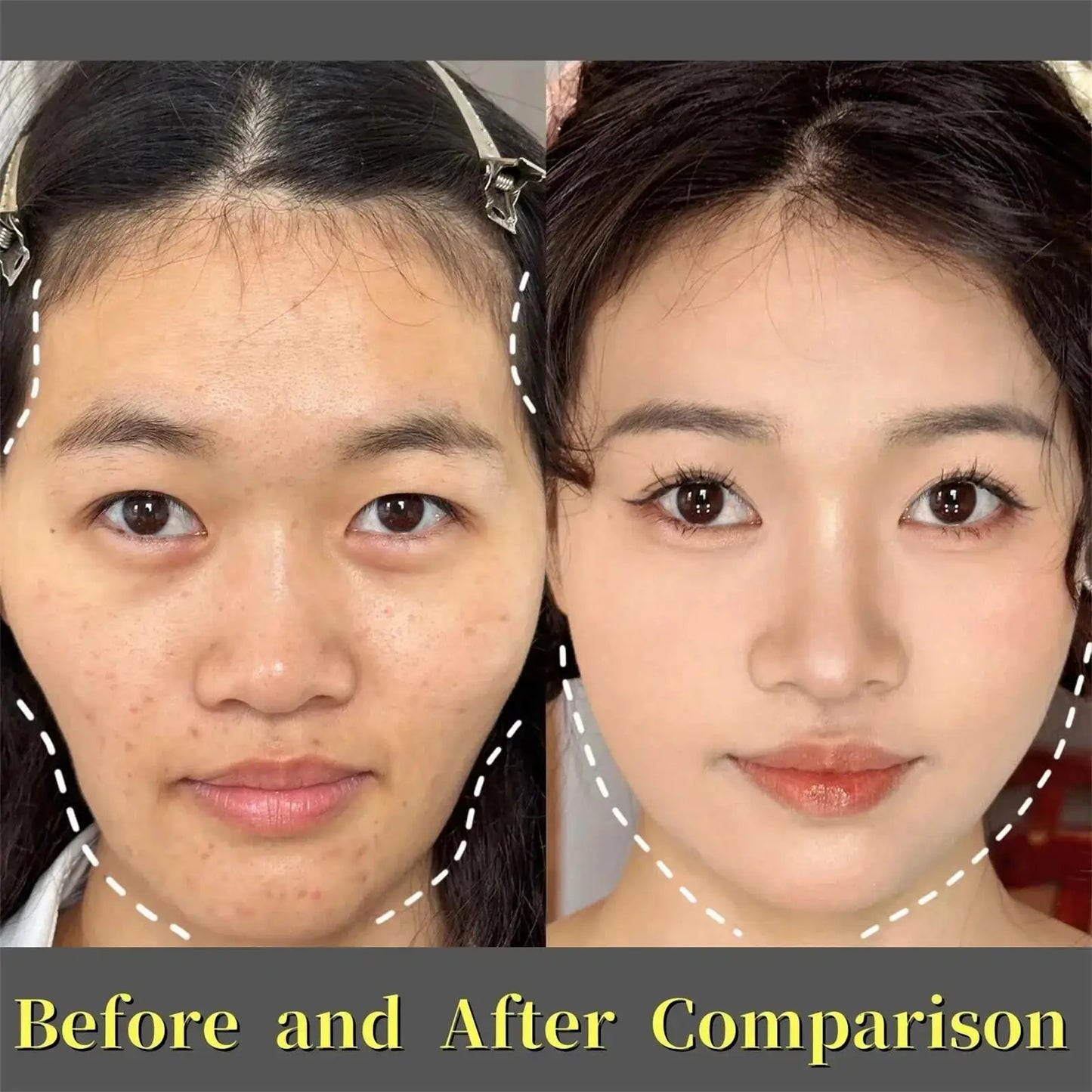 Firming Hydrocrystalline Patch – Anti-Aging Facial Mask