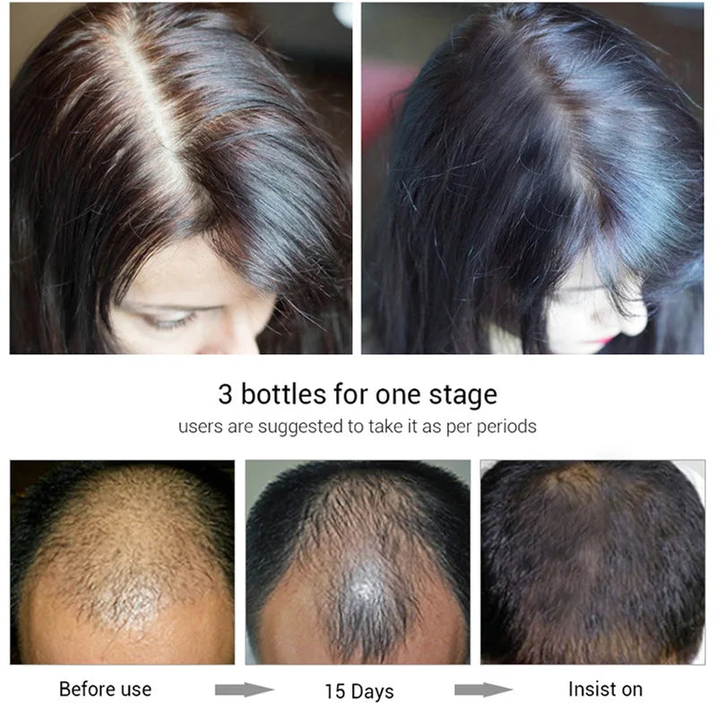 Biotin Hair Growth Shampoo – Anti-Hair Loss Treatment