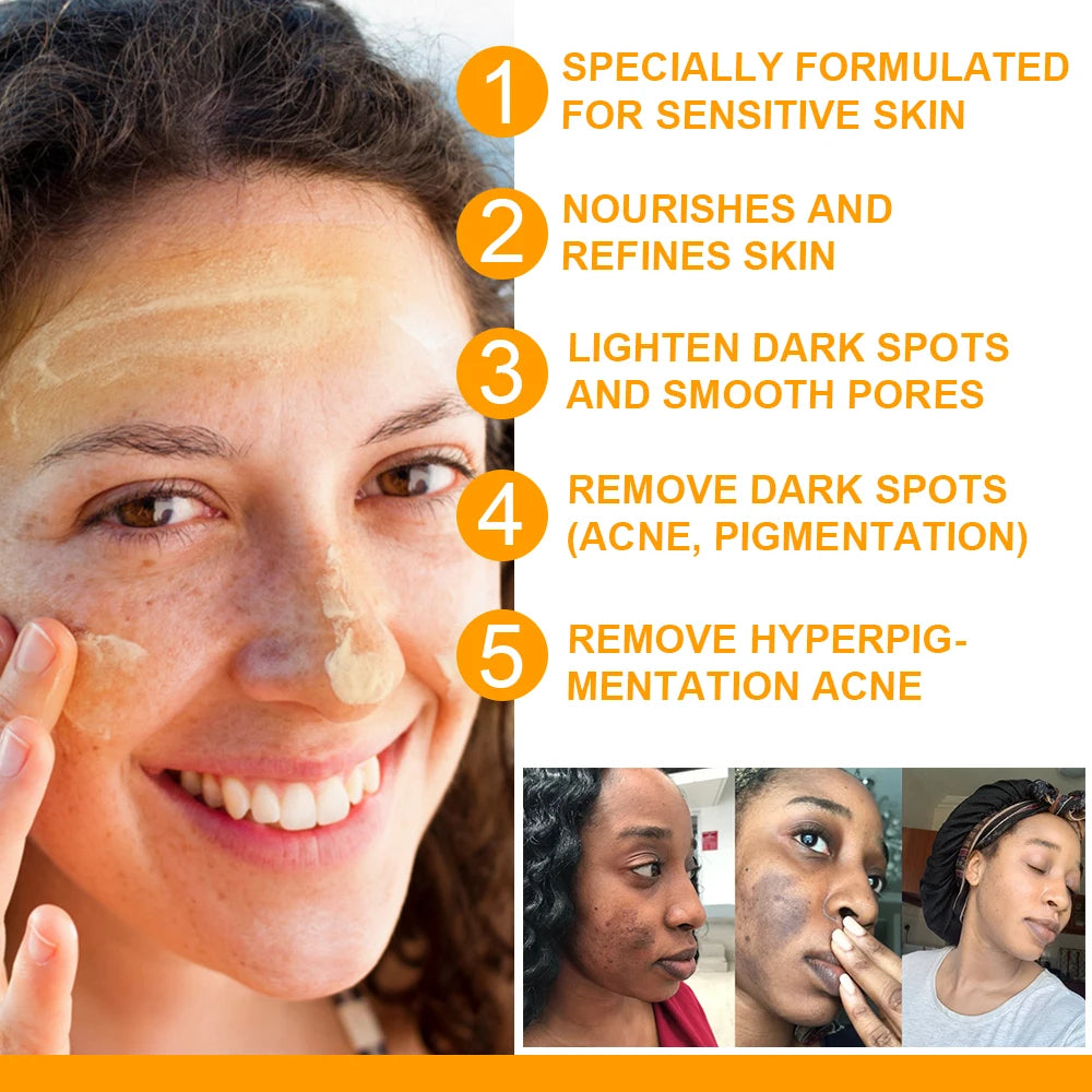 Gluta Maste Dark Spot Cream – Pore Minimizer & Anti-Acne Brightening