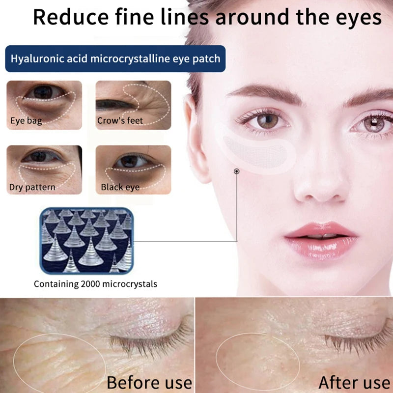 Hyaluronic Acid Microneedle Eye Patches – Moisturizing & Firming