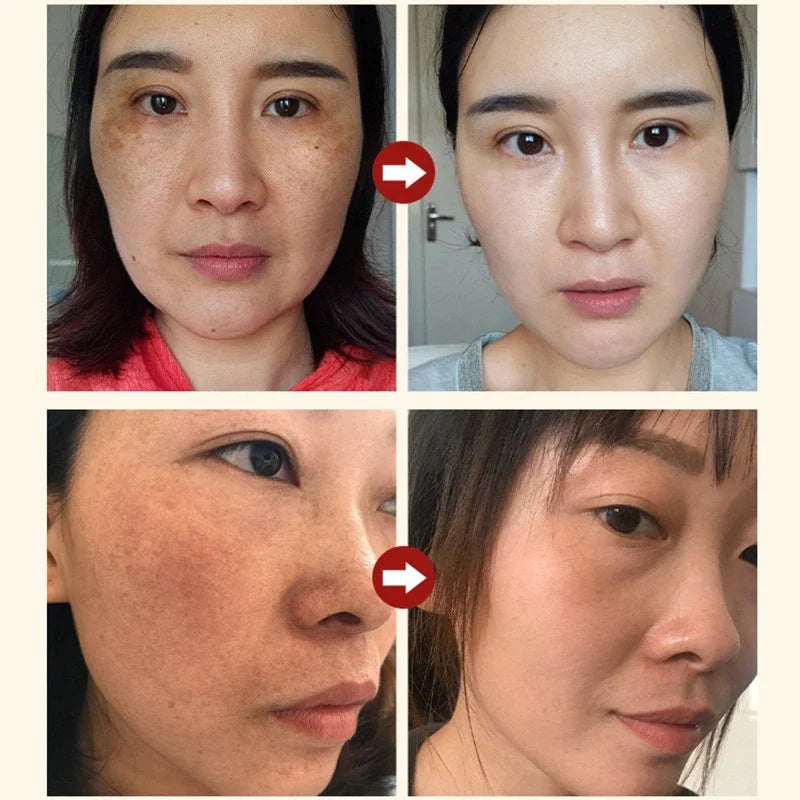 Niacinamide & Salicylic Acid Serum – Sensitive Skin Repair