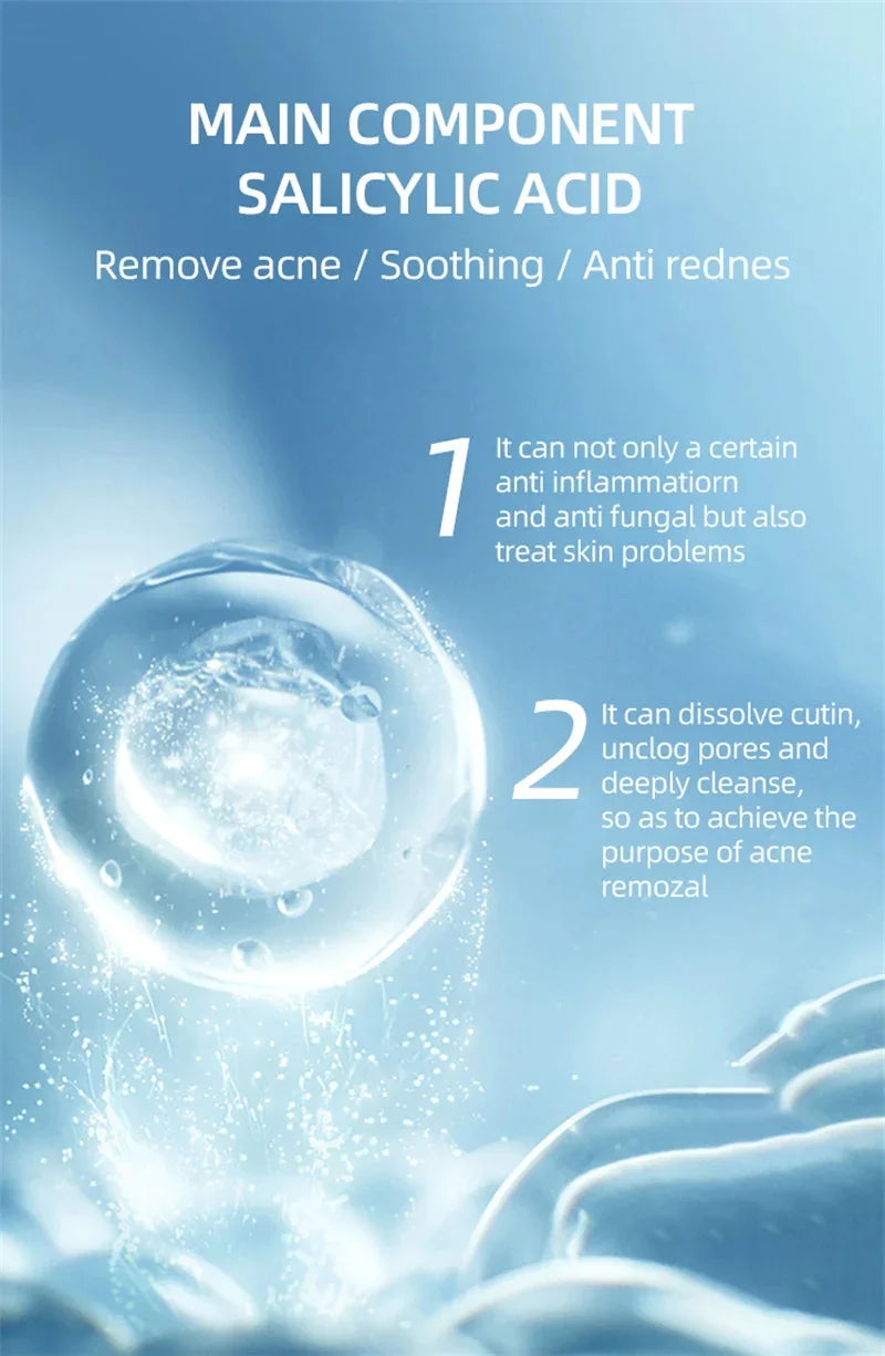 Acne Face Cream – Pimple Treatment & Oil Control Care