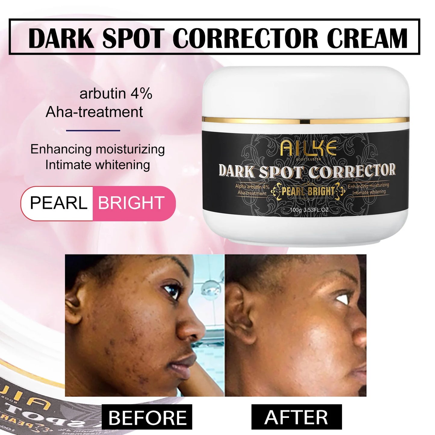 AILKE Bleaching Cream – Dark Spot Remover for Body & Face