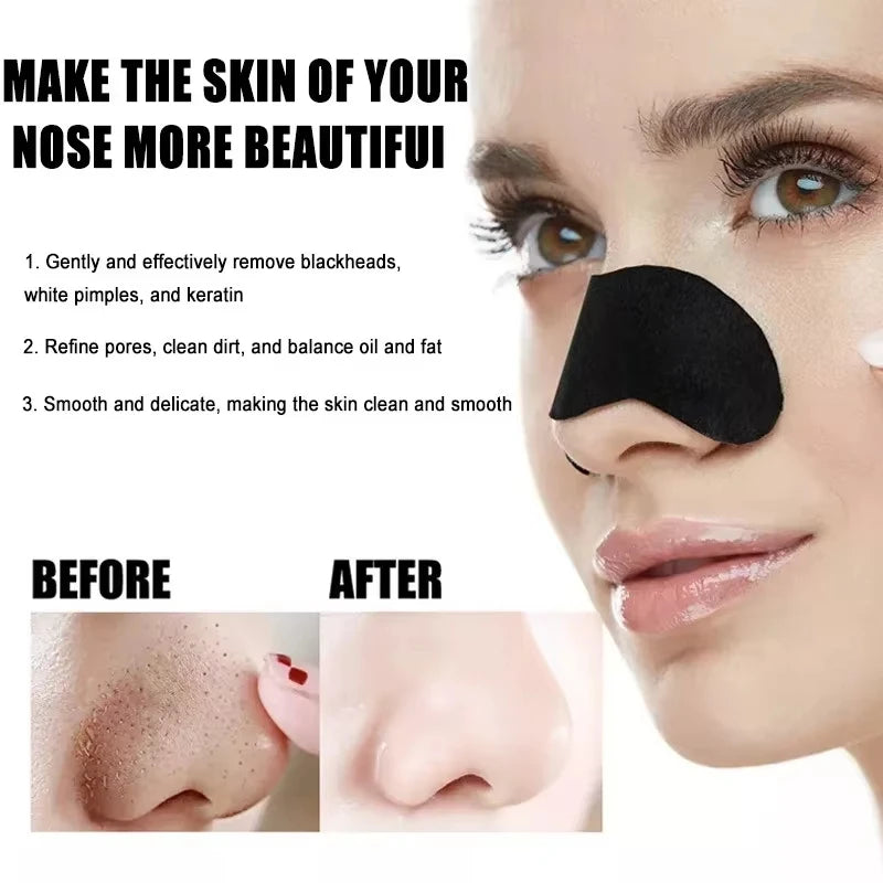 Blackhead Remover Nose Patches – Deep Cleansing (10/50/100pcs)