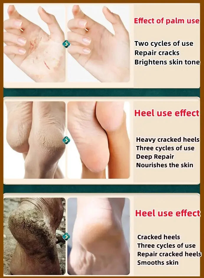 Collagen Hand Cream – Soften & Repair Dry Skin