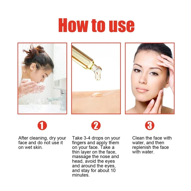 Niacinamide & Salicylic Acid Serum – Sensitive Skin Repair