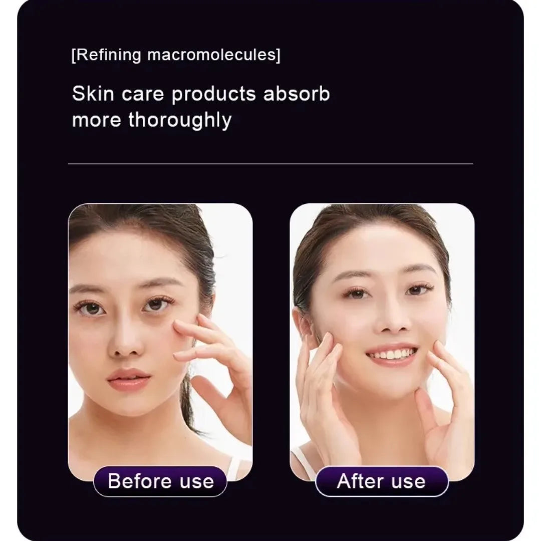 Multi-Function Beauty Device - EMS, Cryo Therapy & LED for Face Lifting & Rejuvenation