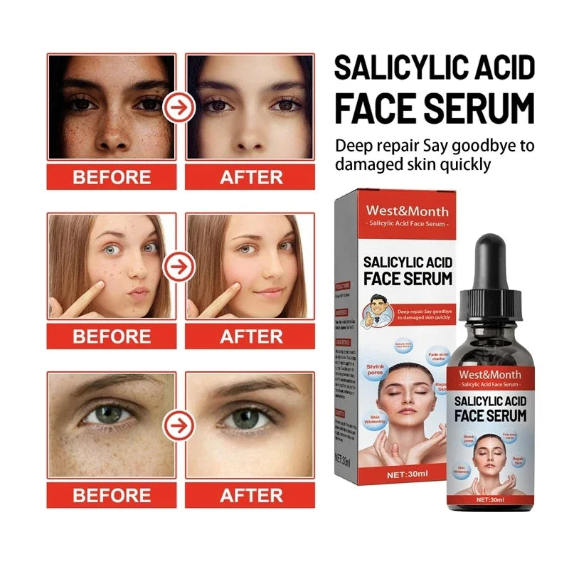 Niacinamide & Salicylic Acid Serum – Sensitive Skin Repair