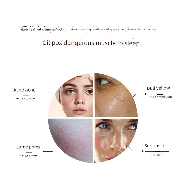 Romasin Amygdalic Acid Essence – Acne & Oil Control Serum