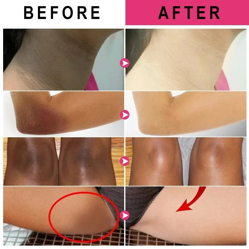 Body Whitening Cream – Intimate & Dark Spot Brightening Lotion