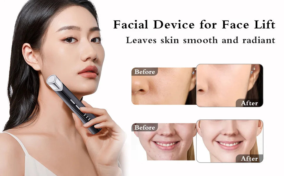 Facial EMS Infusion Beauty Device IPL Skin Rejuvenation Facial Massager Eye Rejuvenation Device