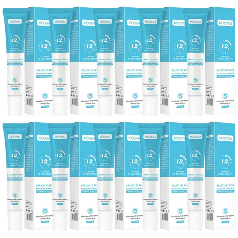 Acne Face Cream – Pimple Treatment & Oil Control Care