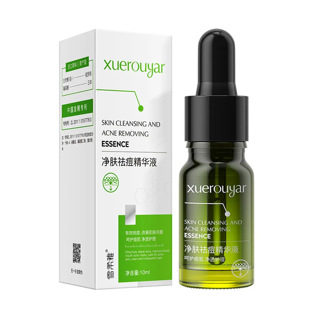 Salicylic Acid Acne Serum – Pore & Oil Control Treatment