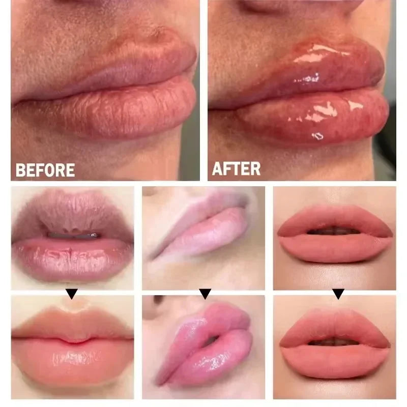 Lip Plump Serum – Hydrating, Volumizing & Anti-Fine Line Care
